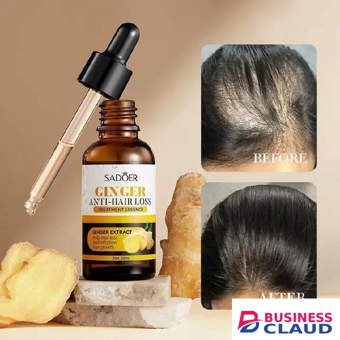 SADOER Quality Anti Hair Loss Treatment Essence, Hair Growth Ginger Extract Beard Growth,Hair Growth, Anti Dandruffs Hair Moisturizing Hair Care Serum, Derma Roller compliment in Anti Hair Loss