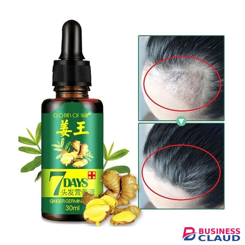 7 Day Clothes Of Skin Hair Growth Oil Essential Oil Hair Loss Treatment Oil *--