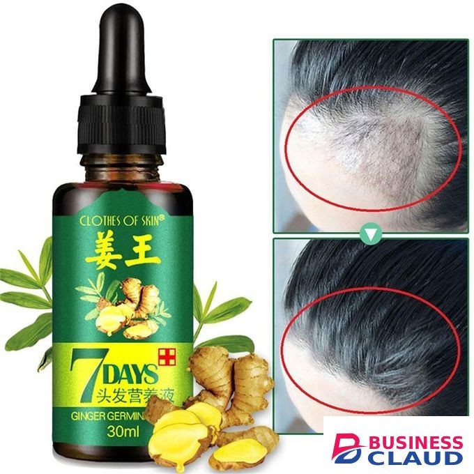 7 Day Clothes Of Skin Hair Growth Oil Essential Oil Hair Loss Treatment Oil *--