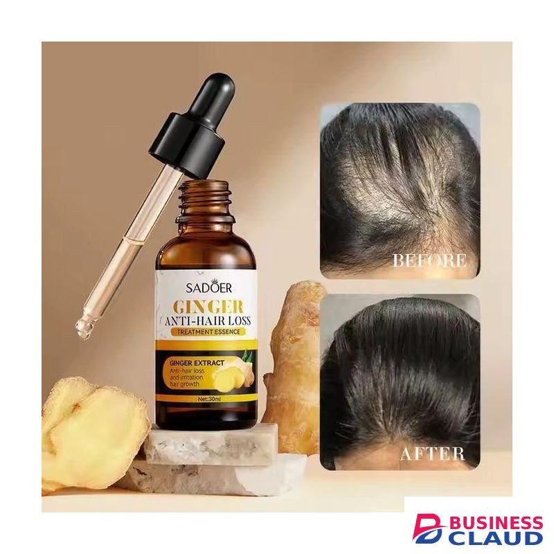 SADOER Ginger Anti Hairloss Treatment Essence, Hair Growth Restoration Anti Hair Loss Serum