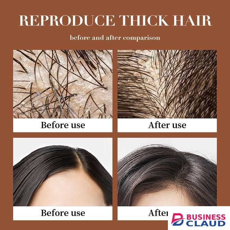 SADOER Quality 2 in 1 Hair Shampoo+Anti Hair Loss Essense SERUM Treatment Shampoo Essence, Hair Growth Ginger Extract Beard Growth,Hair Growth, Anti Dandruffs Hair Moisturizing Hair Care Shampoo, Derma Roller Compliment In Anti Hair Loss