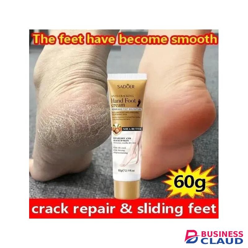 Anti-Crack Repair Cream Moisturizing Anti-Dry Hand, Foot and Heel Cracked Repairing Chapped Foot Moisturzing Callus Remover