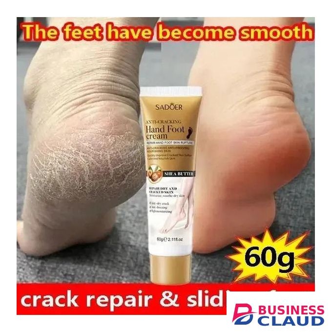 Anti-Crack Repair Cream Moisturizing Anti-Dry Hand, Foot and Heel Cracked Repairing Chapped Foot Moisturzing Callus Remover