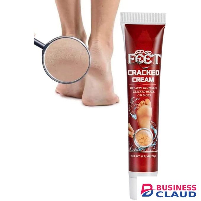 cracked heel cream, Foot Cream Heel Balm, heel Foot Cream, Cooling Feet Repair Cream, Heel Repair cream for Dry Cracked Feet, Chapped ointment, Cracked Feet, Deeply Moisturizes foot cream