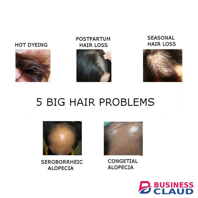 Disaar Anti Hair Loss Essence For Healthy, Strong, And Thick Hair Growth, Treats Baldness And Weak Brittle Hair