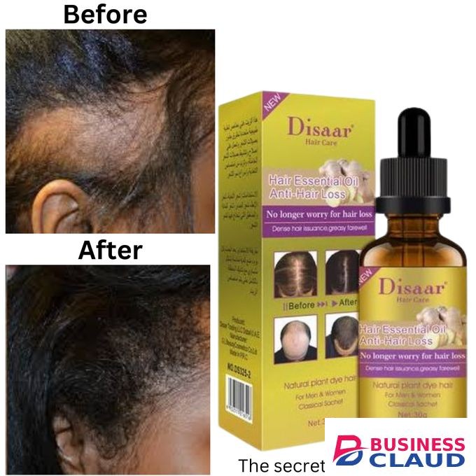 Disaar Hair Essential Oil Ginger Anti-Hair Loss Unisex, 30g