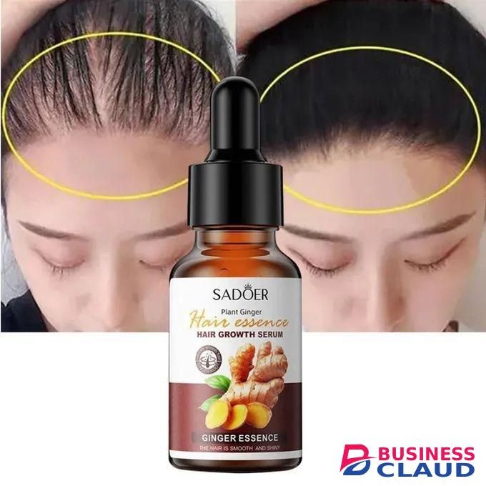 Hair Growth Oil Serum Ginger Fast Hair Growth Activator Anti Hair Loss Products Hair Booster - 3OML