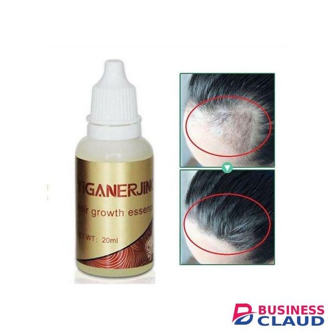 YIGANERJING Fast Growth Essence Liquid Hair Natural Loss Treatment Scalp