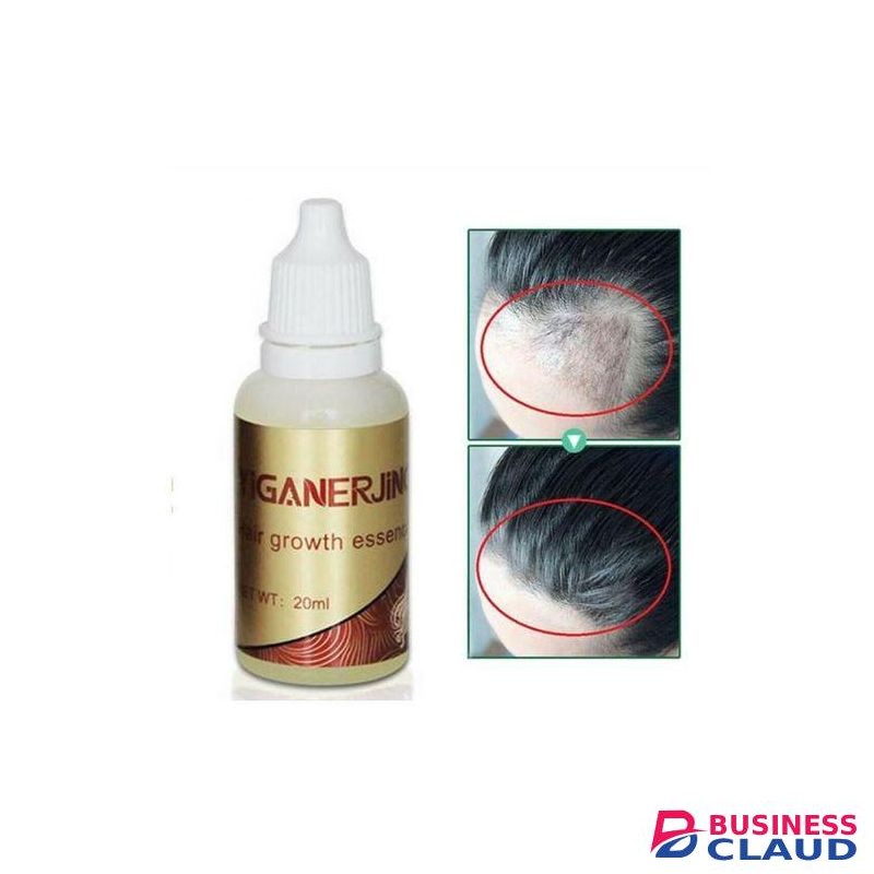 YIGANERJING Fast Growth Essence Liquid Hair Natural Loss Treatment Scalp