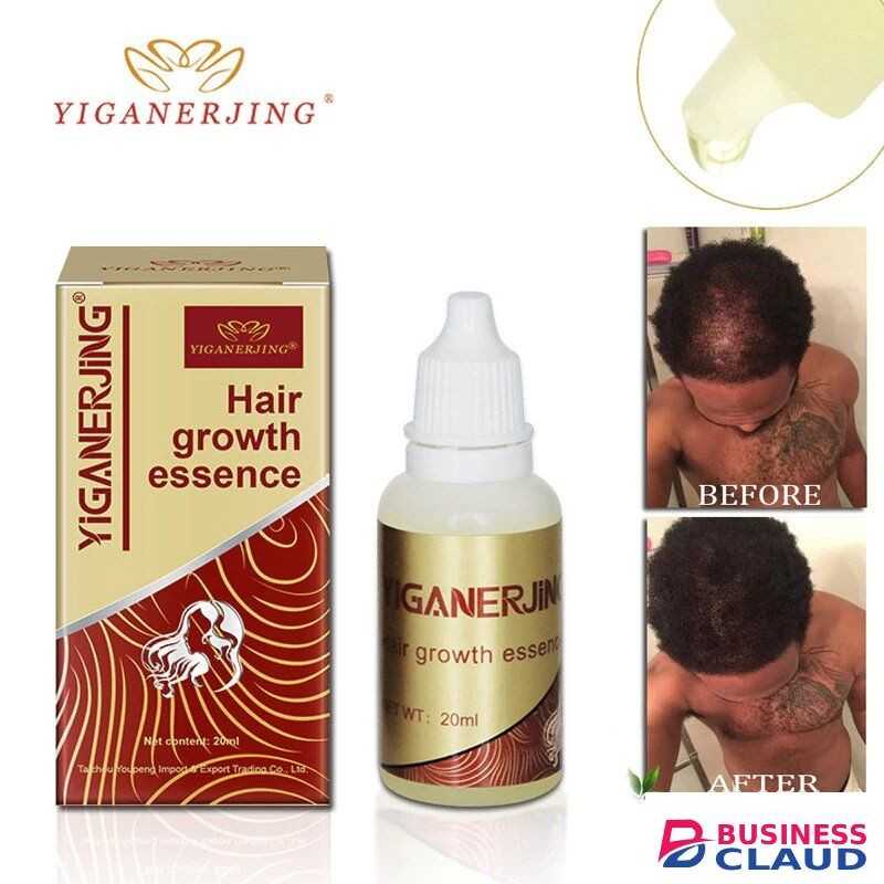 YIGANERJING Original Hair Growth Oil Fast Restoration Natural Hair Loss