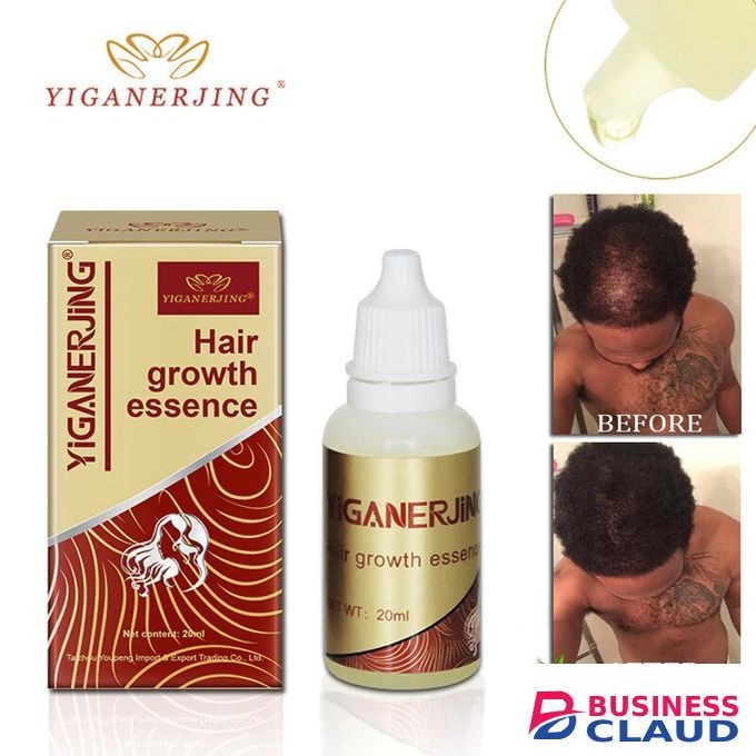 YIGANERJING Original Hair Growth Oil Fast Restoration Natural Hair Loss