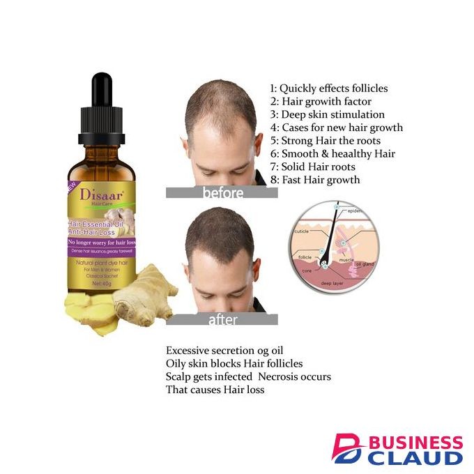 Disaar Anti-Hair Loss & Scalp Essential Oil - Hair & Beard Oil