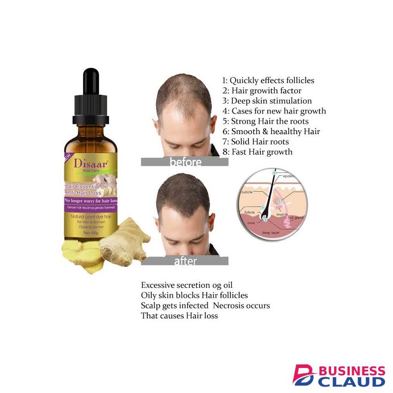 Disaar Anti-Hair Loss Essential Oil Ginger Essence, 30ml