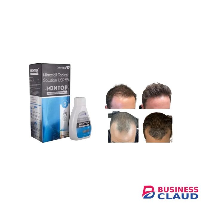 Minoxidil 5% Solution Mintop Forte Restores Hair Prevents Male Baldness