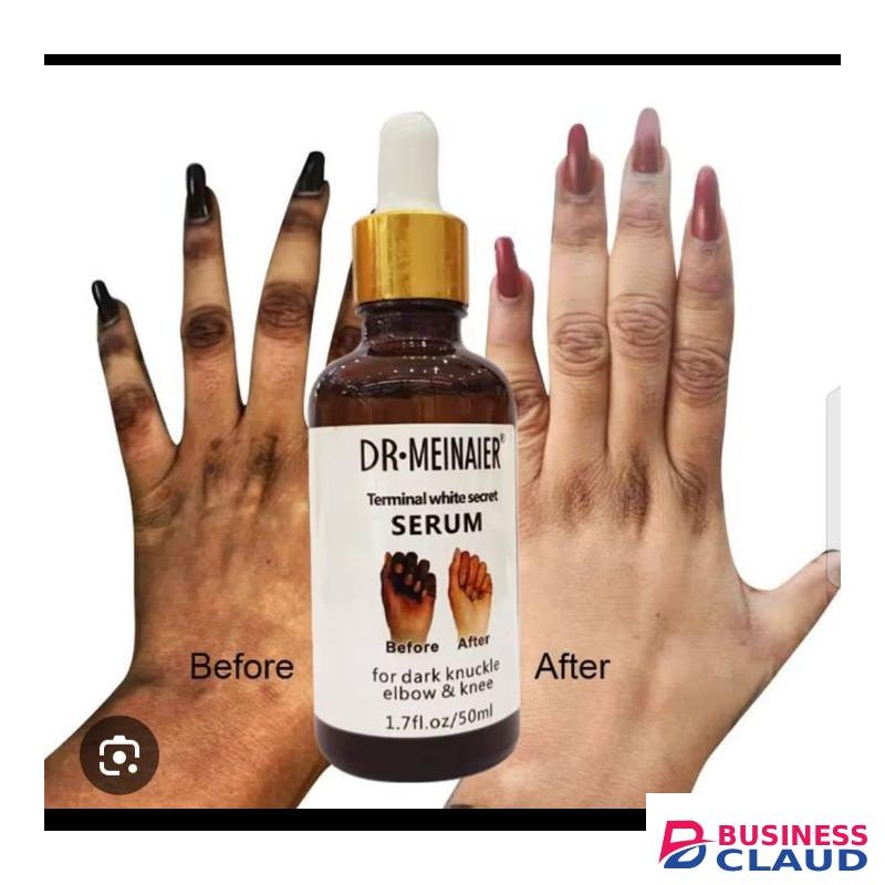 DR MEINAIER Brightening Secret Serum for Dark Knuckles, Knees & Elbows – Skin Lightening Care