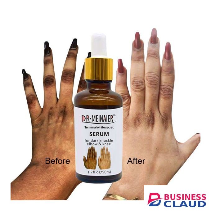 DR MEINAIER Serum For Dark Knuckle Elbow & Knee - 50ml