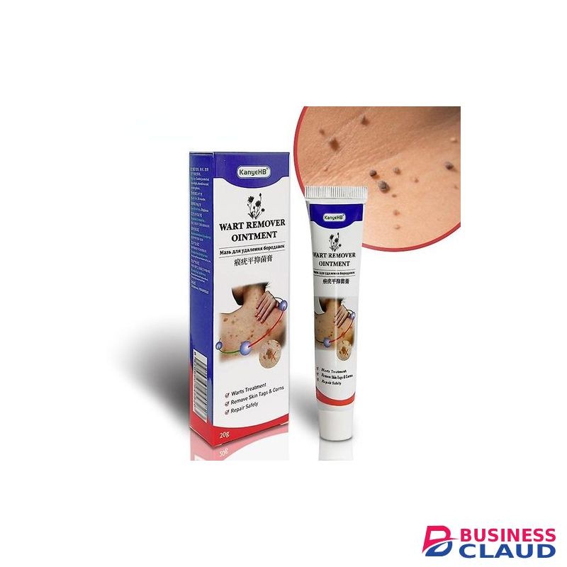 Warts Remover Ointment Warts Remover