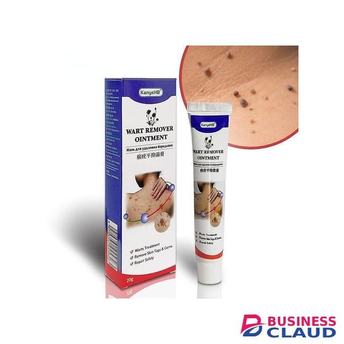 Warts Remover Ointment Warts Remover