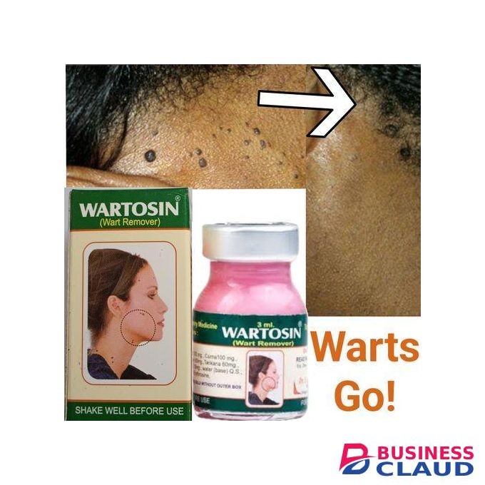 WARTOSIN Skin Cream For Warts Removal - Clear Spots Tags pp