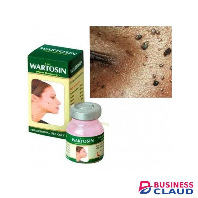 WARTOSIN Ayurvedic Warts Remover/Removal Cream Ointment pp