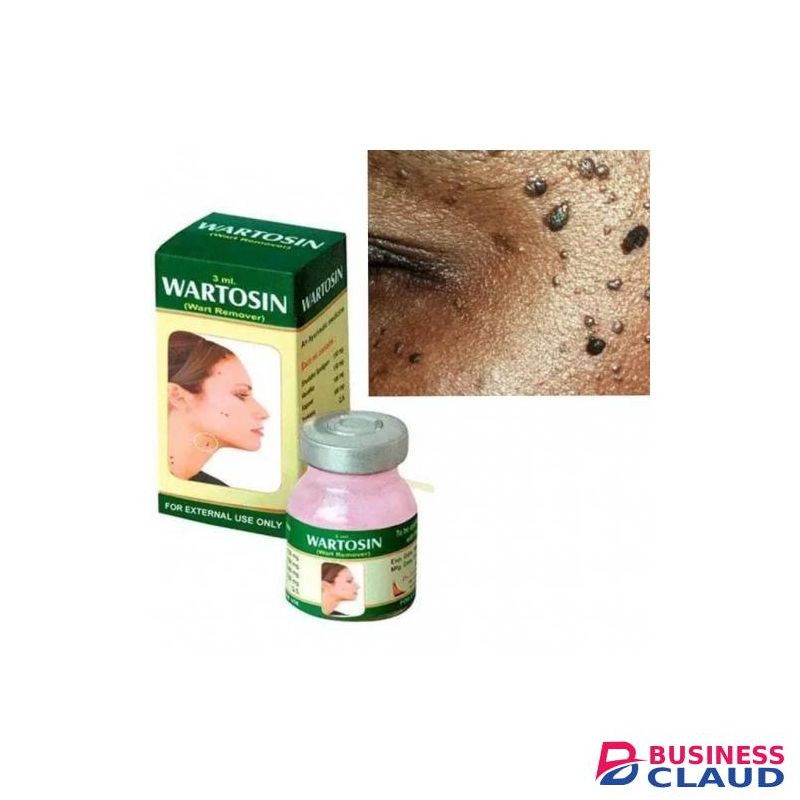 WARTOSIN Ayurvedic Warts Remover/Removal Cream Ointment pp