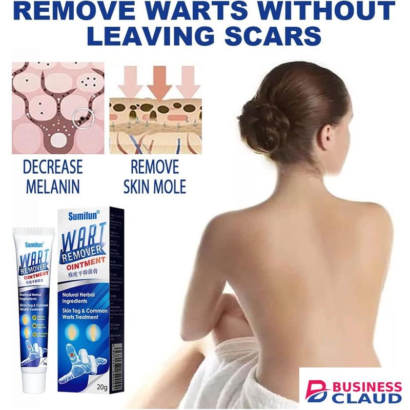 Wart Remover Ointment