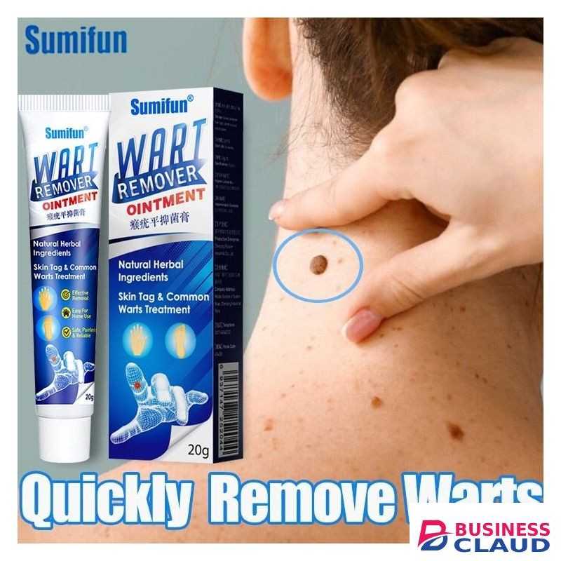 Warts Remover Cream Warts Removal Ointment Skin Tag Remover