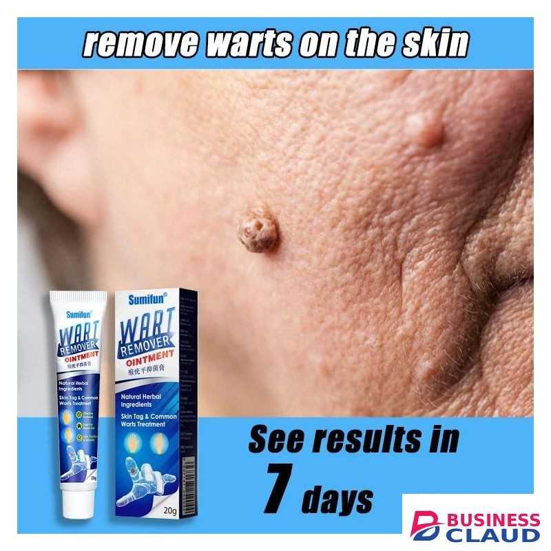 Warts Remover Cream Warts Removal Ointment Skin Tag Remover