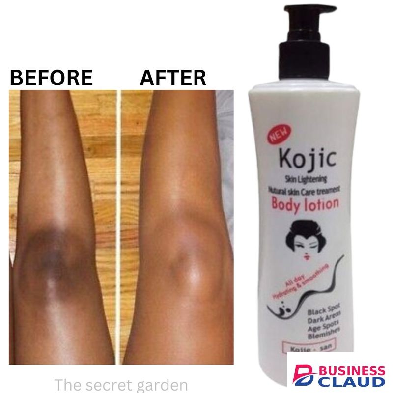 Dr Kojicc Acid Skin Lightening And Brightening ,Black Spots/age Spots/dark Areas Remover Kojic Acid Body Lotion