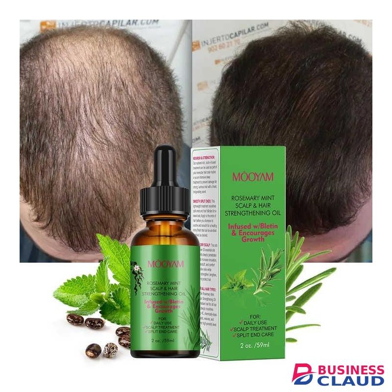Rosemary Mint Scalp & Hair Strengthening Oil Scalp Treatment With Biotin Hair Growth Rosemary Mint Oil Hair Nourishing