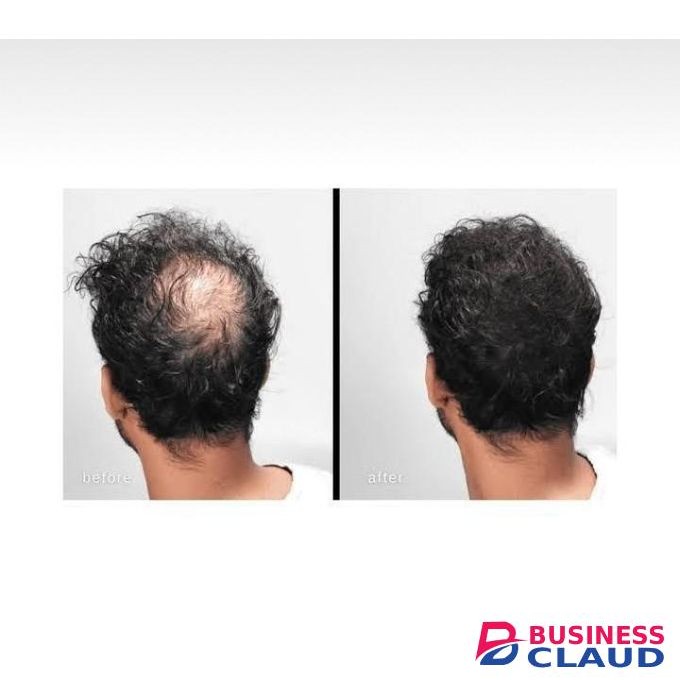 Toppik Hair Building Fibres 27.5g Black USA