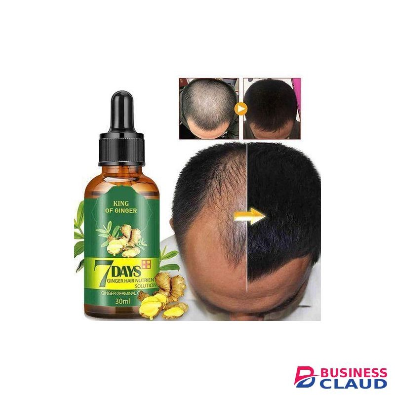 Clothes Of Skin Hair Tonic & Beard Growth Anti-hair Loss Ginger Oil minoxidil
