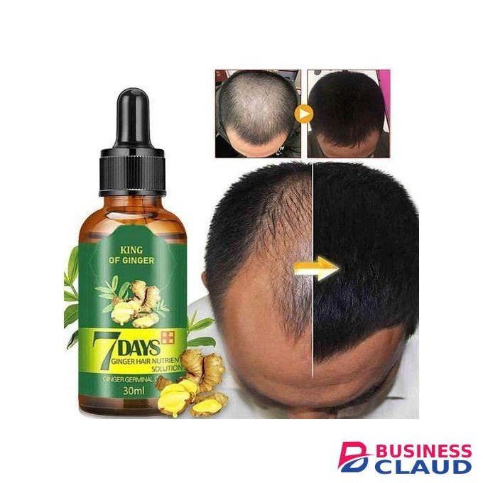 Clothes Of Skin Hair Tonic & Beard Growth Anti-hair Loss Ginger Oil minoxidil