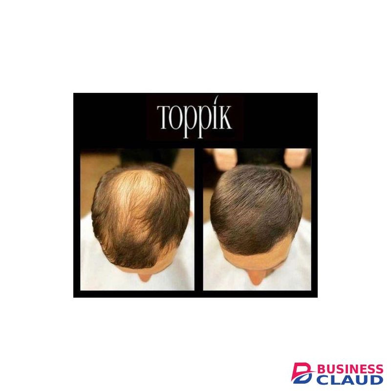 Toppik Hair Building Fibres(BROWN)